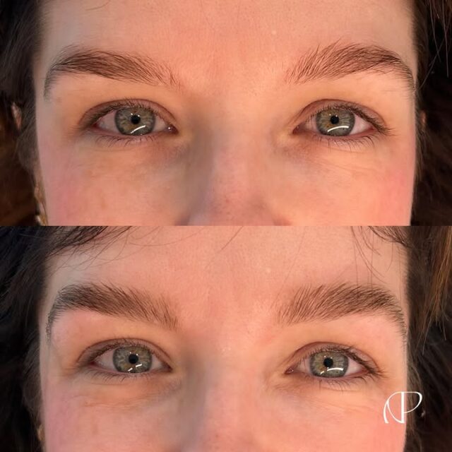 We’re all about full, natural brows! ✨

Your brows show your feelings and keeping them full and natural enhances your unique beauty without changing who you are. We LOVE THIS!

Less overdone, more confident look! Does that make sense to you?

Appointments & 1:1 Courses - Link in Bio✨

#studioapco #naturalbrows #nanobrowspmu #neutralbay #mosman #sydney