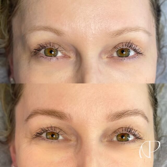 Existem muitas pessoas para cuidar da sua vida 👀

Mas para cuidar do processo de reconstrução das suas sobrancelhas tem NÓS! 🤎

Cliente gestante. Que fase linda, abençoada por Deus, mas que requer bastante cuidado com a saúde. Amamos receber nossas clientes para realizar os tratamentos com segurança e leveza. Nossas gravidinhas também merecem um cuidado especial e sofisticado. 

Clica no link da Bio para saber mais. Atendimentos em Porto Alegre & Caxias do Sul.

#sobrancelhas #studioapco #marcapessoal #imagemeestilo #reconstrucaodesobrancelhas