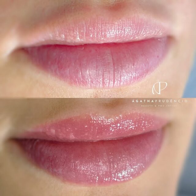 Para quem já tem lábios lindos, mas gostaria de revitaliza-los com uma corzinha 🤌🏻✨ 

Apresento a NanoLips, técnica que encanta nossas clientes aqui no @studioapco ! A NanoLips é uma técnica suave e extremamente segura para lábios sensíveis ou com pequenas falhas de coloração. Proporciona coloração com bordas suaves e um efeito de lábios corados e saudáveis. Quem também ama esse efeito natural? 💋

✨ Esta Cliente queria um efeito natural, sem as bordas marcadinhas, e com aquela corzinha de “saúde”.

✨Durabilidade de aproximadamente 12 meses.

✨ Informações e agendamentos, clica no link da Bio.

Atendimentos Porto Alegre e Caxias do Sul.
————————
STUDIO AP & Co®️ | Porto Alegre • +55(51) 99561-1348
STUDIO VG®️ | Caxias do Sul • +55(54) 99983-8872