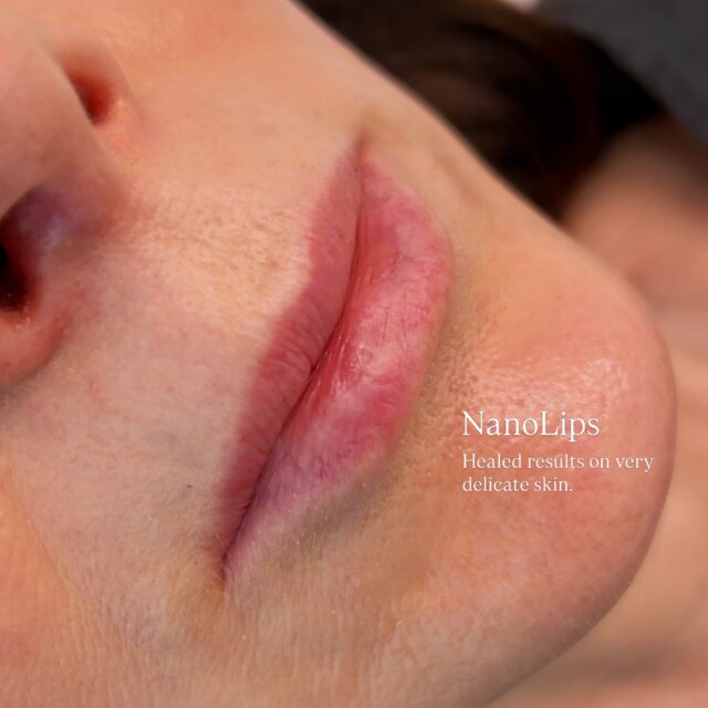 Every result is unique 🤎 NanoLips ✨ H E A L E D. 

It’s essencial to book a CONSULTATION to understand the steps, before and after care, and also to align the details for a better result. Every skin type and health conditions matter, and the healing process work differently.

This is a modern and gentle semi-permanent lip pigmentation technique, recommended for those who want a natural tint with soft finishing.

Lasting: 8-12 months.

Appointments & Courses: Link in Bio.
Available in Portuguese and English. 
4 Young Street, Neutral Bay (Inside @sanctuaryskincare ).